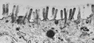 celiakia celiakia